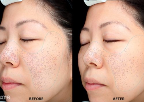 칙칙함 제거 방법을 찾았어요! 칙칙함 제거 방법을 찾았어요!